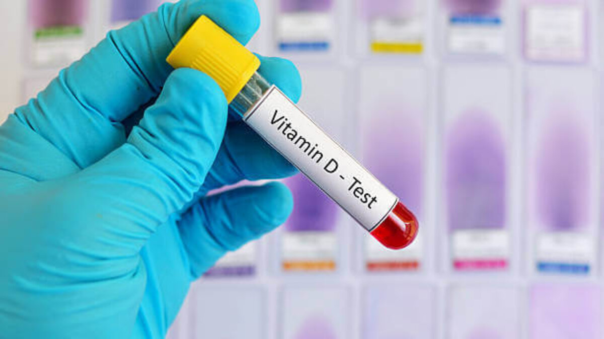 Vitamin_D_Test