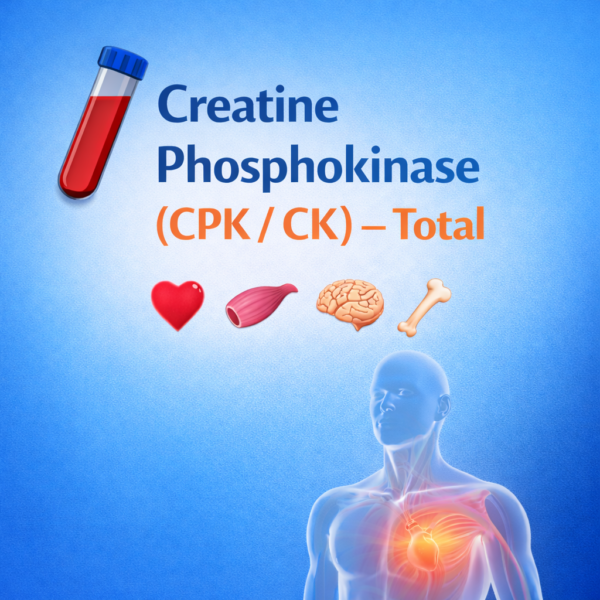 CPK Total - Creatine Phosphokinase